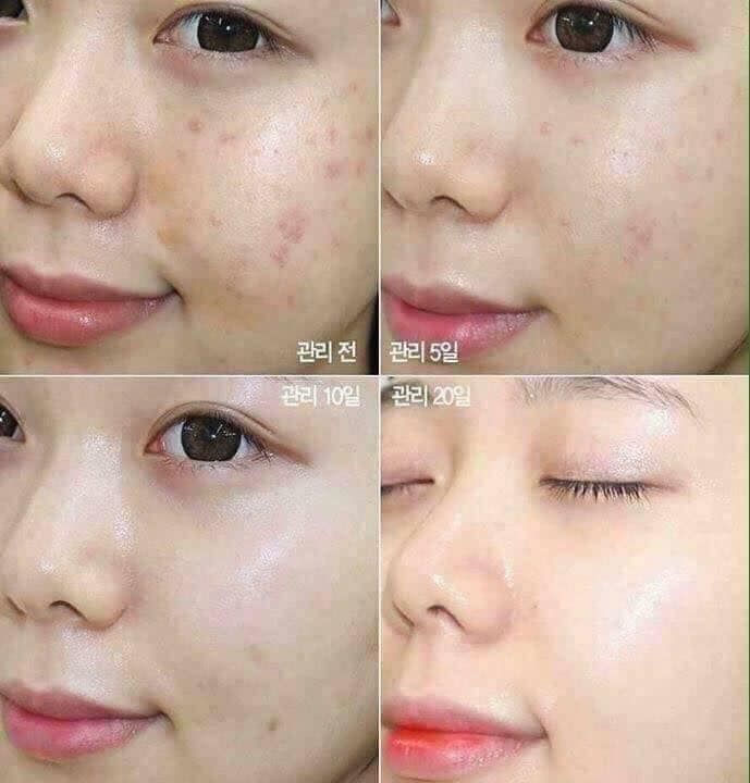 Mẫu mới) Tinh chất rau má Skin1004 Madagascar Centella Asiatica 100 A –  Juka Beauty