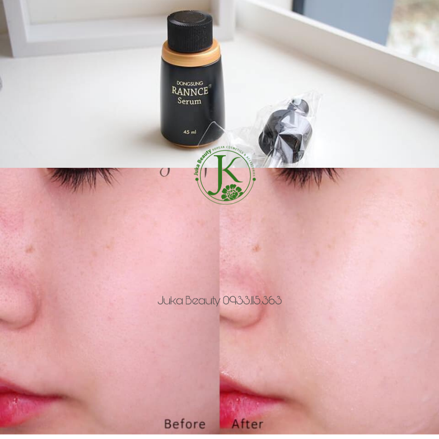  Tinh Chất Dưỡng Trắng, Giảm Nám DongSung Rannce Serum 45ml 