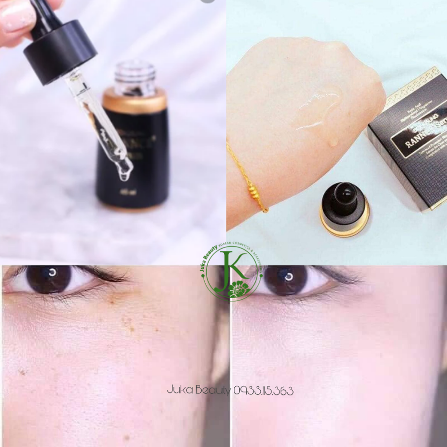  Tinh Chất Dưỡng Trắng, Giảm Nám DongSung Rannce Serum 45ml 