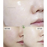  (Mẫu mới) Mặt nạ giấy cấp ẩm, dịu da Banobagi Vita Genic Jelly Mask 30g (1 miếng) 