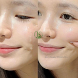  Tinh Chất Keo Ong Cho Da Dầu Mụn CNP Laboratory Propolis RESCUE Ampule 5ml/50ml 