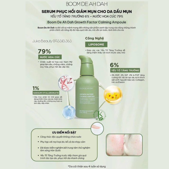  Tinh Chất Làm Dịu, Phục Hồi, Giảm Mụn Boom De Ah Dah Growth Factors Calming Ampoule 50ml 