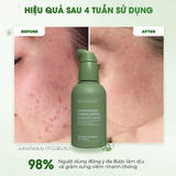  Tinh Chất Làm Dịu, Phục Hồi, Giảm Mụn Boom De Ah Dah Growth Factors Calming Ampoule 50ml 