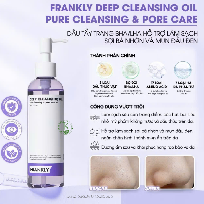  Dầu Tẩy Trang Sạch Mụn Ẩn, Mụn Đầu Đen Frankly Deep Cleansing Oil 200ml 