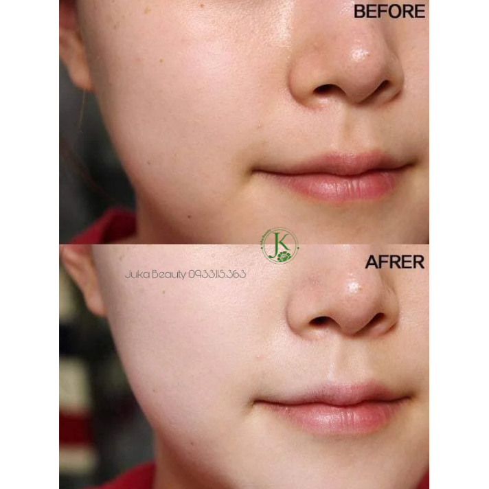  [Bản UK] Kem Dưỡng Da Ban Ngày Có Chống Nắng Olay Total Effects 7 In One Day Moisturiser Nourish & Protect SPF15 50ml 