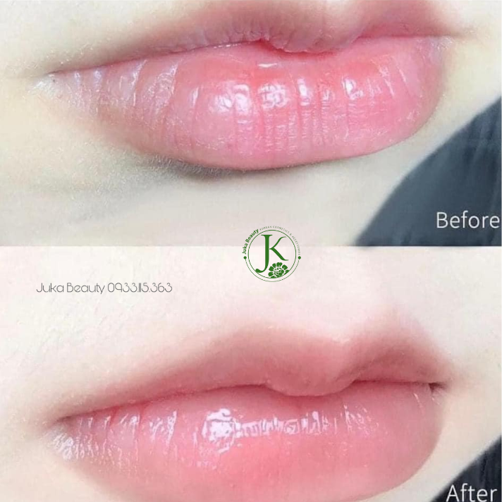  Dưỡng môi mềm, căng mọng Vaseline Lip Therapy 7g 