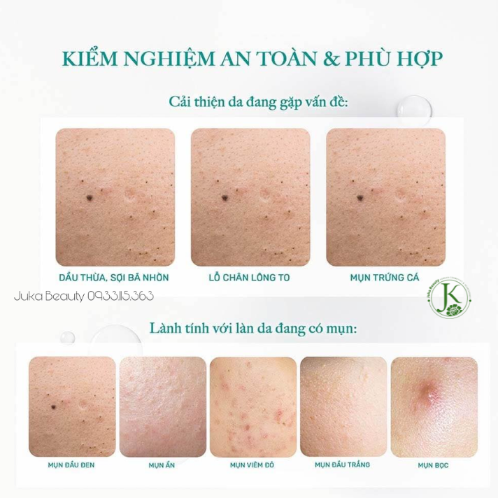  Tẩy Trang Thuần Chay Sạch Sâu Derladie Cleansing Water Witch Hazel Micellar Unscented 5 IN 1 500ml 