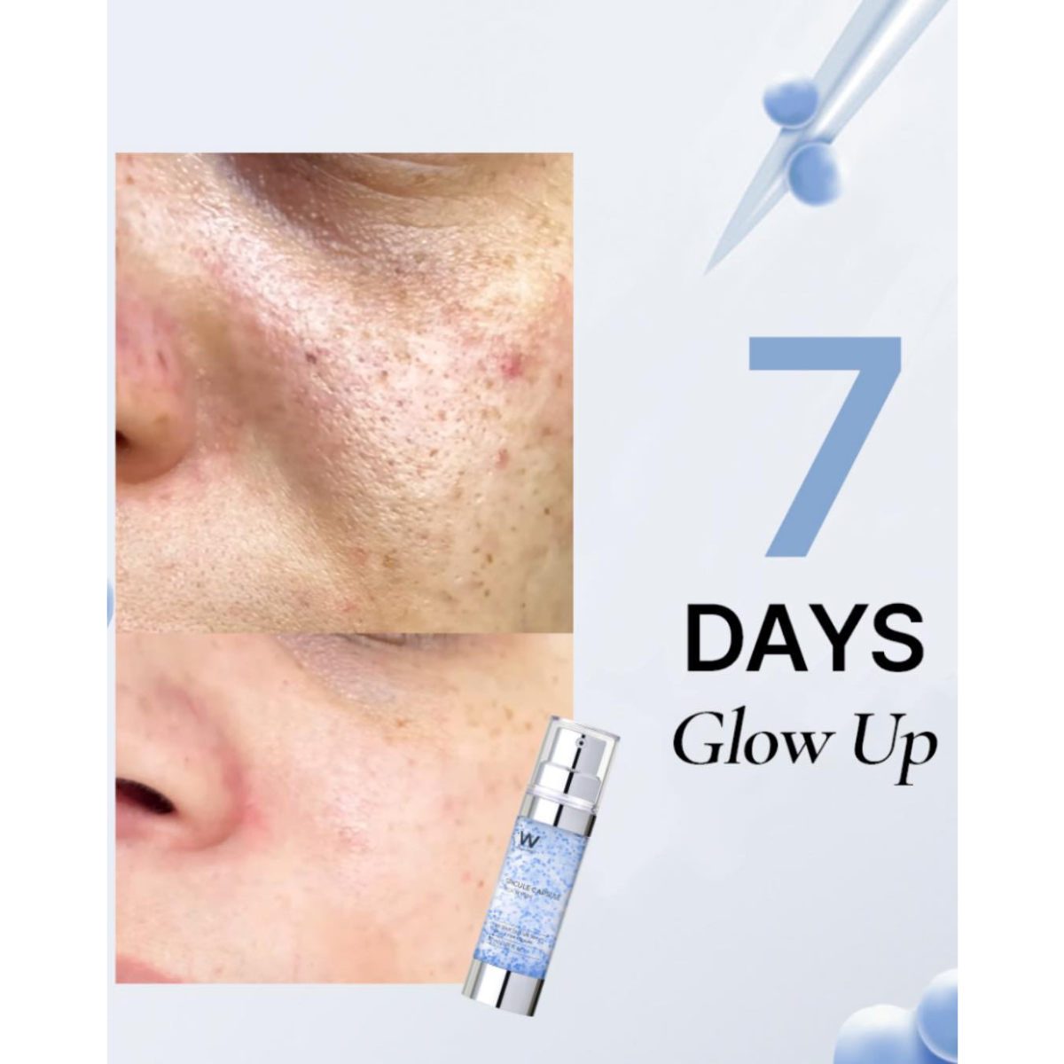  (Mẫu mới) Tinh chất vi kim tái tạo da Wonjin Effect Spicule Capsule Teca Serum 30ml 