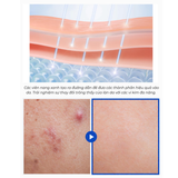  (Mẫu mới) Tinh chất vi kim tái tạo da Wonjin Effect Spicule Capsule Teca Serum 30ml 