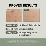  Kem dưỡng ốc sên phục hồi, ngừa lão hóa Jumiso Snail Mucin 88+ Peptide Facial Cream 100ml 