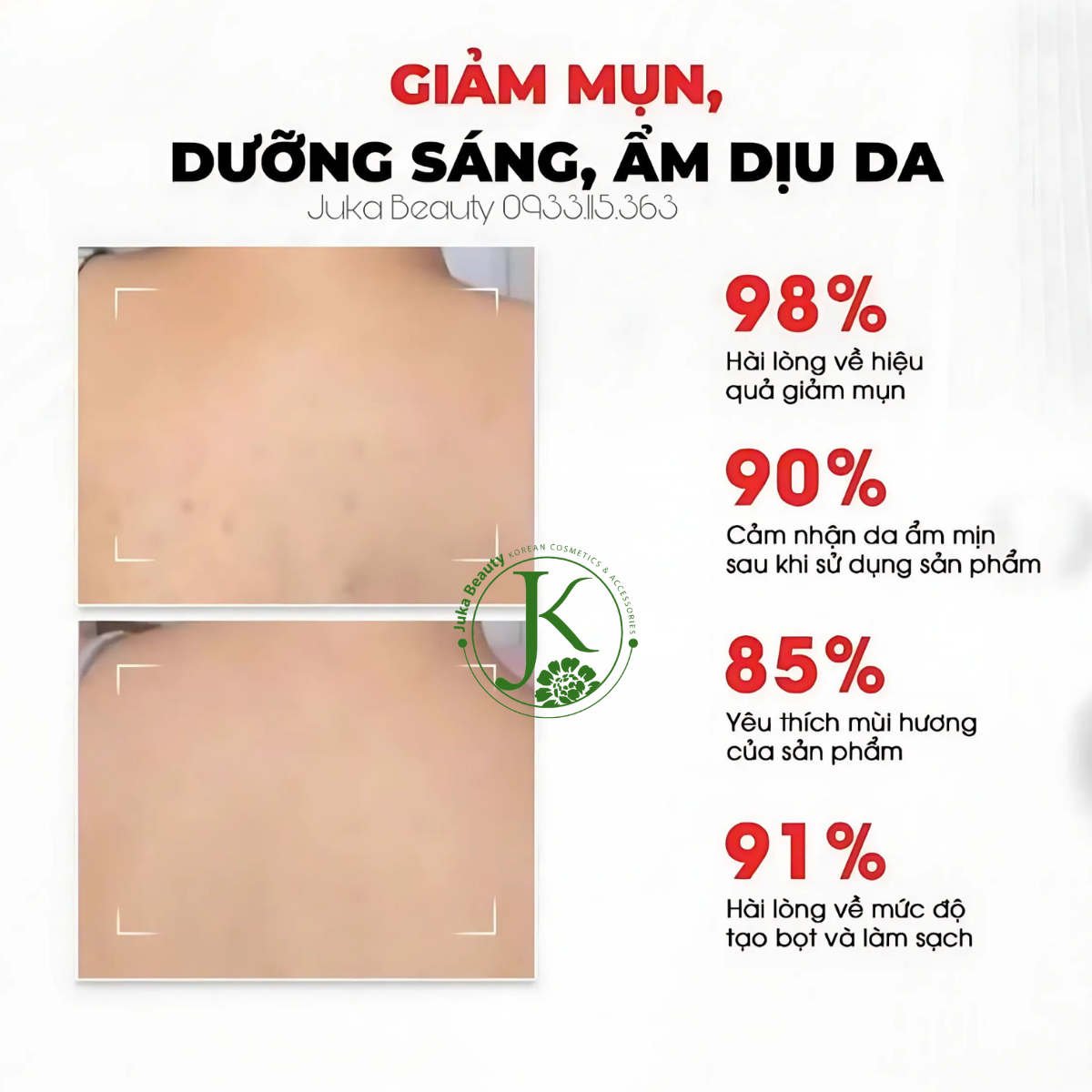  Sữa Tắm Giảm Mụn, Mờ Thâm Angel's Liquid Glutathione BHA Exfoliating Body Wash 500g 
