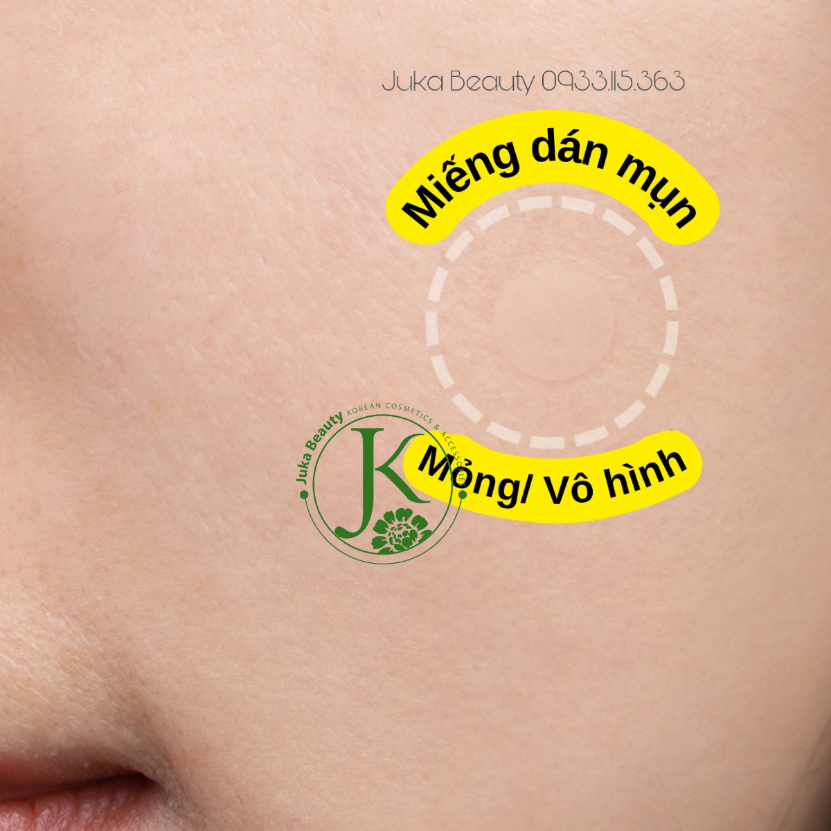  Miếng Dán Mụn Vô Hình Tiam Surprise H Patch (18 miếng) 