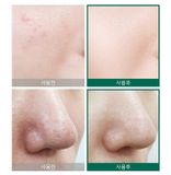  Nước Hoa Hồng Giảm Mụn 30 Ngày Some By Mi AHA BHA PHA 30 Days Miracle Toner 150ml 