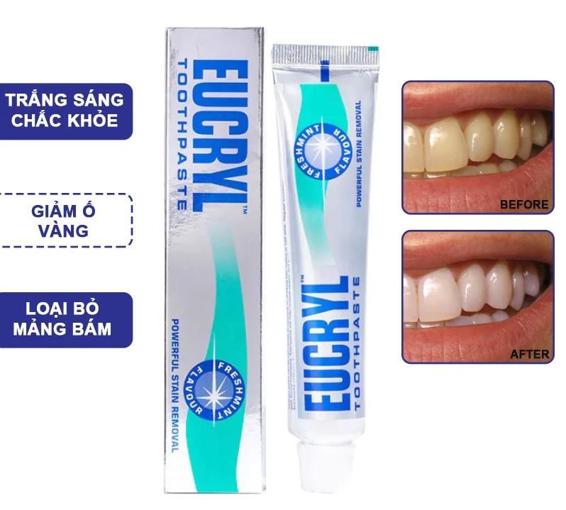  Kem Đánh Răng Hương Bạc Hà, Giúp Trắng Răng Eucryl Toothpaste Freshmint 50g 