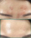  Kem dưỡng ẩm, giảm mụn Some By Mi AHA BHA PHA 30 Days Miracle Cream 60g (Mẫu mới) 
