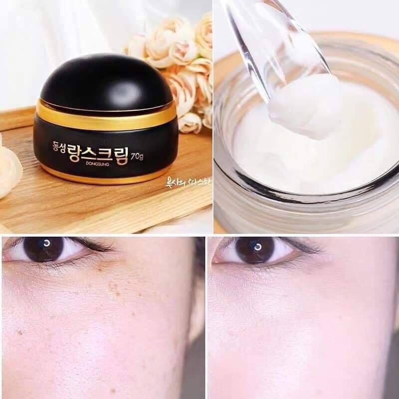  Kem Dưỡng Giảm Nám, Mờ Tàn Nhang Dongsung Rannce Cream Hàn Quốc 