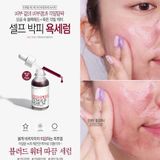  Tinh Chất Tẩy Da Chết Hóa Học So Natural Red Peel Tingle Serum 35ML 