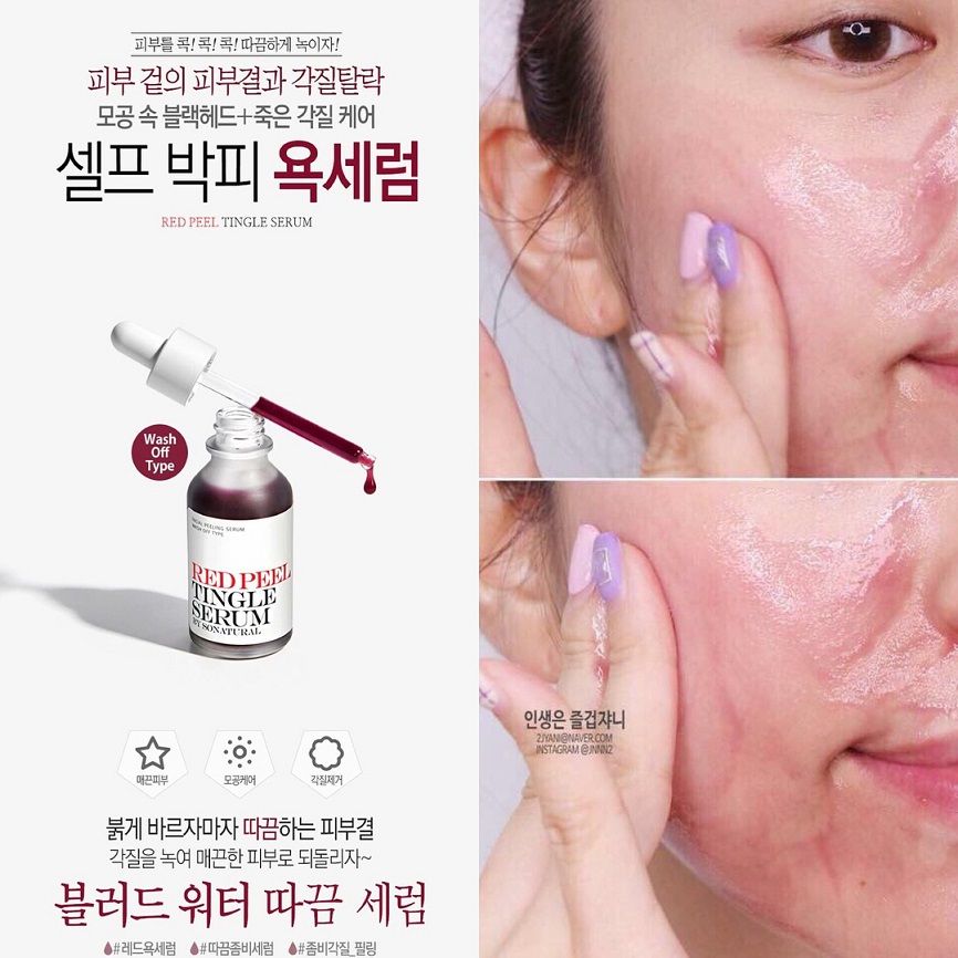  Tinh Chất Tẩy Da Chết Hóa Học So Natural Red Peel Tingle Serum 35ML 