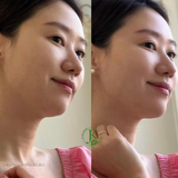  Tinh Chất Dưỡng Trắng, Mờ Thâm ISOI Blemish Care Up Serum (TÁCH SET) 