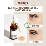  Tinh Chất Phục Hồi, Chống Lão Hóa Manyo Bifida Biome Complex Ampoule 