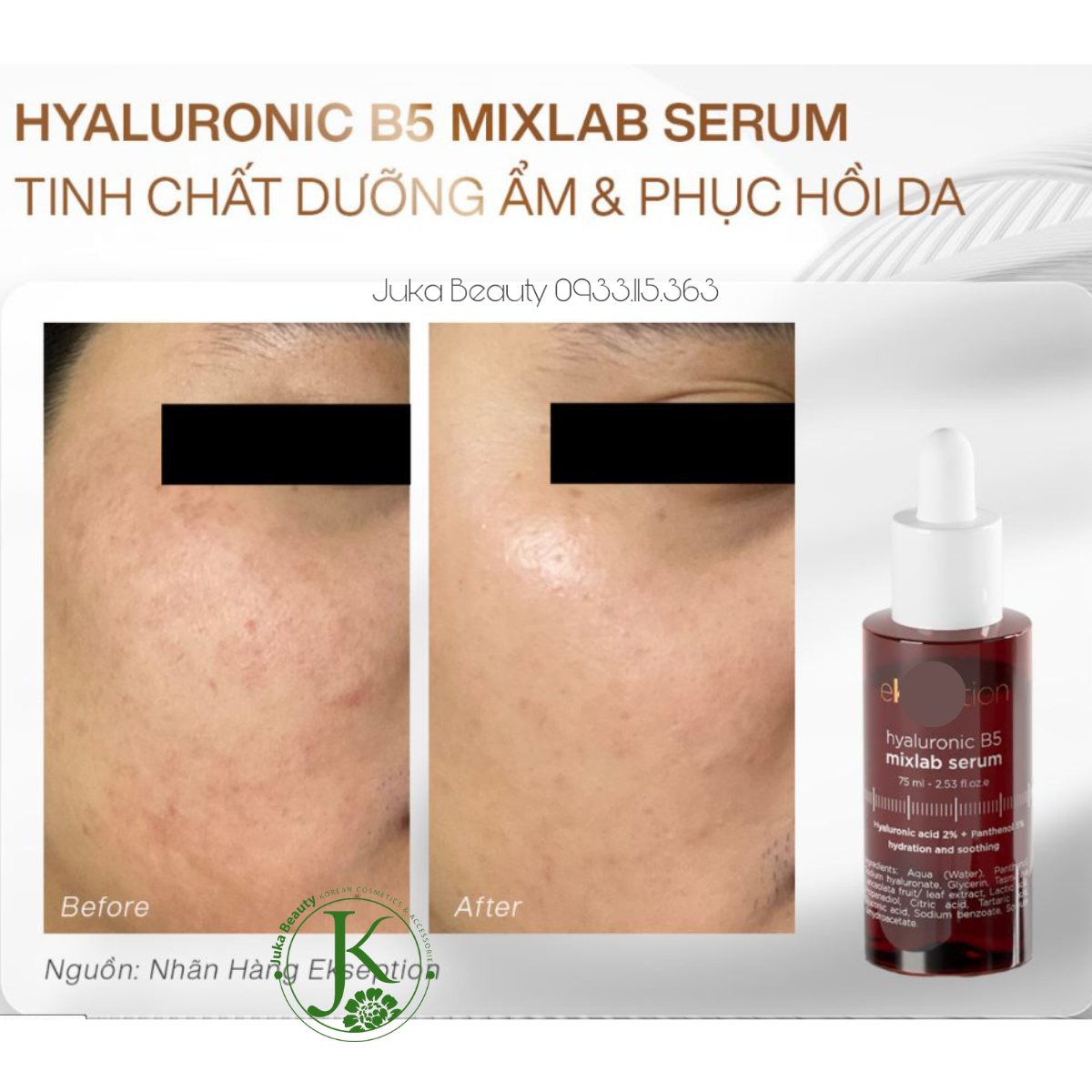  Tinh Chất Dưỡng Ẩm, Phục Hồi Da Ekseption Hyaluronic B5 Mixlab Serum 75ml 