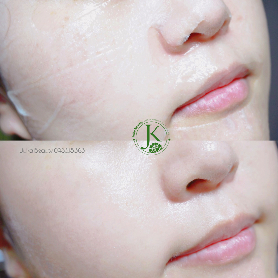  Mặt nạ cấp ẩm, phục hồi da SMAS Peptide Silk Mask 24hr Hydration Boost 25g (1 miếng) 