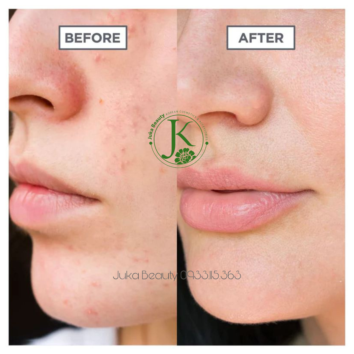  Tinh Chất Phục Hồi, Kiềm Dầu Neogen Real 15% Niacinamide Serum 30ml 