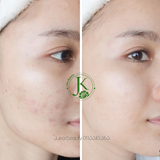  Siêu Tinh Chất Dưỡng Trắng, Mờ Thâm Neogen Dermalogy Real Vitamin C Serum 32g 