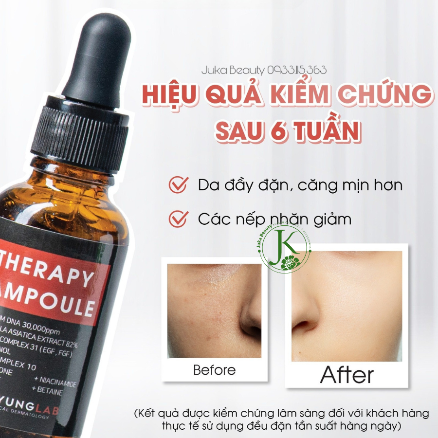  Tinh Chất Tế Bào Gốc Phục Hồi Da Kyung Lab PDRN Therapy Ampoule 30ml (Đỏ) 