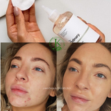  (Mẫu mới) Nước Hoa Hồng Sáng Da, Tẩy Tế Bào Chết The Ordinary Glycolic Acid 7% + Toning Solution 240ml 