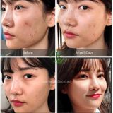  (Mẫu mới) Tinh chất giảm mụn, làm dịu da Some By Mi AHA BHA PHA 30 Days Miracle Serum 50ml 