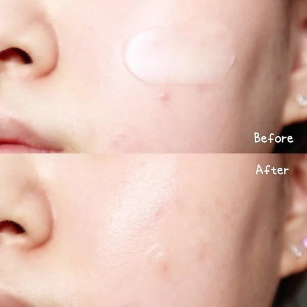  Kem Dưỡng Derladie Tràm Trà Giảm Mụn Kiềm Dầu Derladie Herbal Extract Care Cream 50ml 