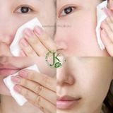  Nước Hoa Hồng Skin1004 Madagascar Centella Poremizing Clear Toner 210ml 