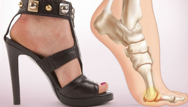 Muốn đi giày cao gót nhưng sợ đau chân? Hãy thử ngay mẹo nhỏ dưới đây! - Ảnh 2. Muốn đi giày cao gót nhưng sợ đau chân? Hãy thử ngay mẹo nhỏ dưới đây! - Ảnh 2.