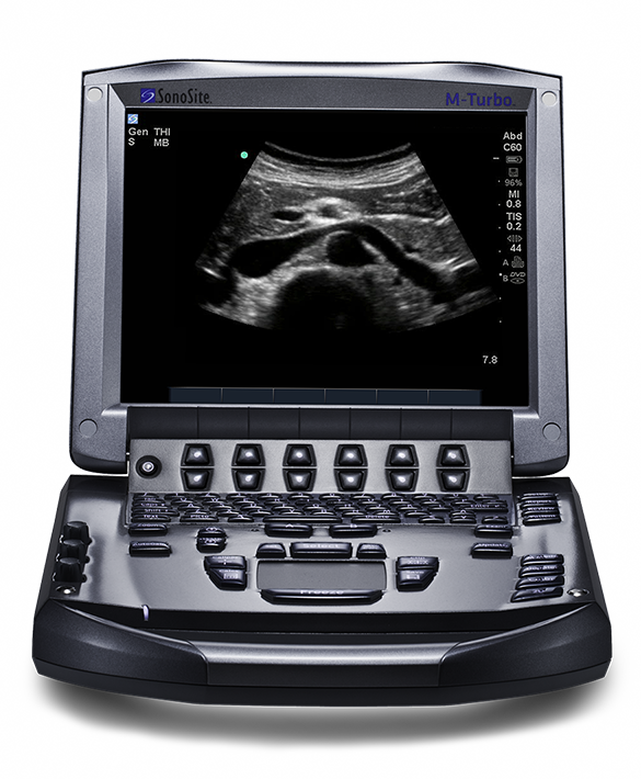 Sonosite M-Turbo