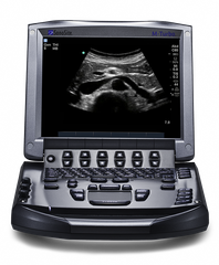 Sonosite M-Turbo