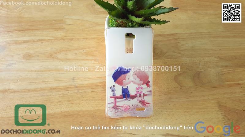 Ốp lưng OPPO R7 Plus dẻo hoạt hình