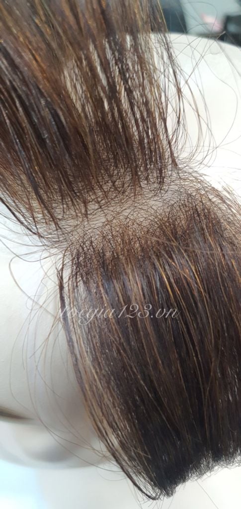 Miếng che hói dán chữ M