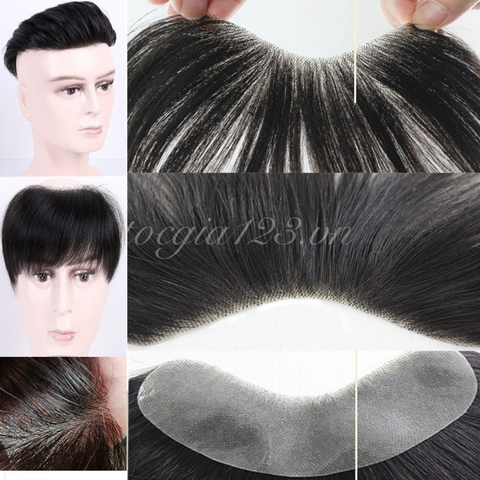 Miếng che hói dán chữ M