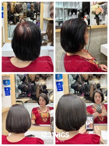 Mái hói da đầu 3918
