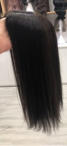 Mái hói da đầu lớn