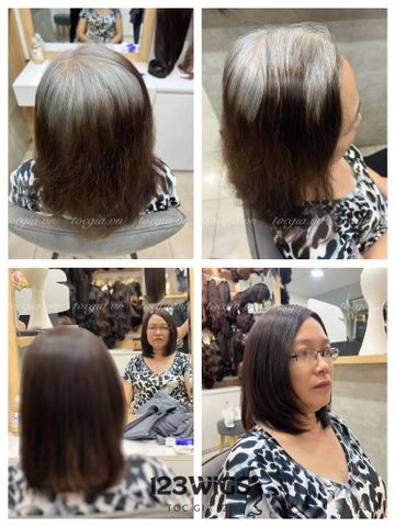 Mái hói da đầu 4956