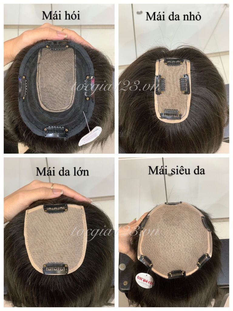 Mái siêu da đầu mỏng