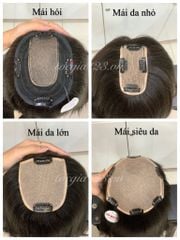 Mái siêu da đầu mỏng