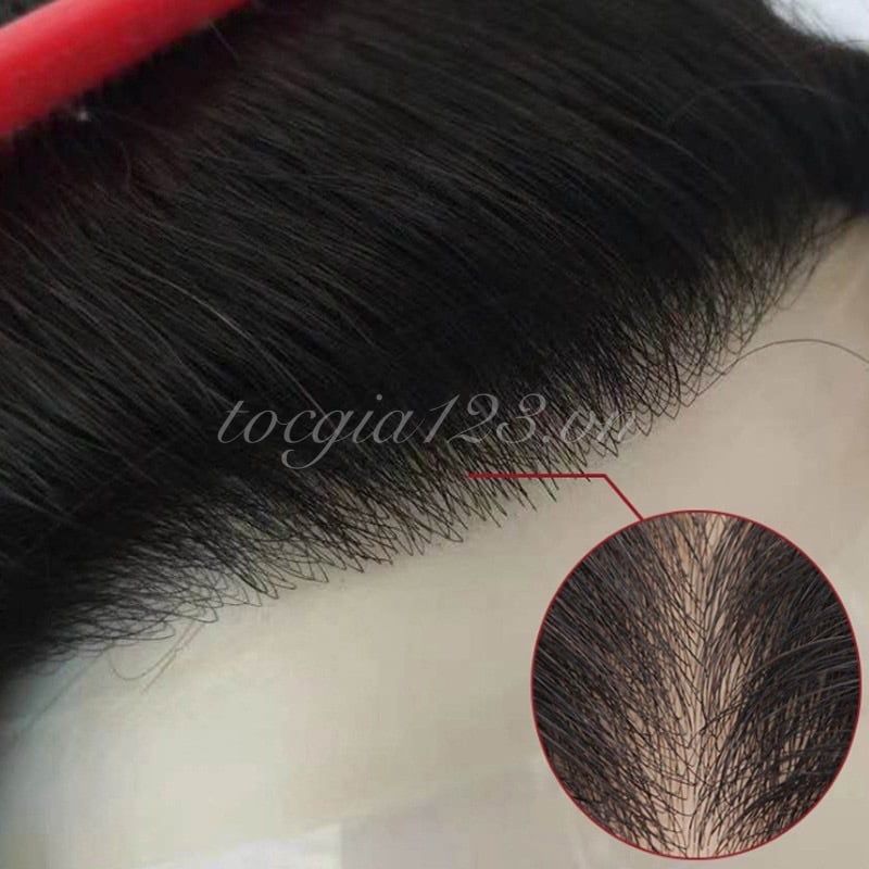 Miếng che hói dán chữ M