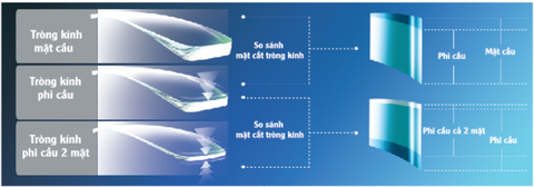 Tròng kính phi cầu 2 mặt là gì