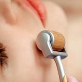  Cây Lăn Kim Chuyên Dụng Hỗ Trợ Tái Tạo Da, Cải Thiện Sẹo 