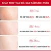 Kem Dưỡng Trị Nám Chuyên Sâu Angel's Liquid Tranexamic Acid Mela Cream