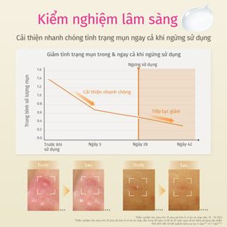  Tinh chất giảm mụn và làm mờ vết thâm D Program Acne Care Spot Essence 15g 