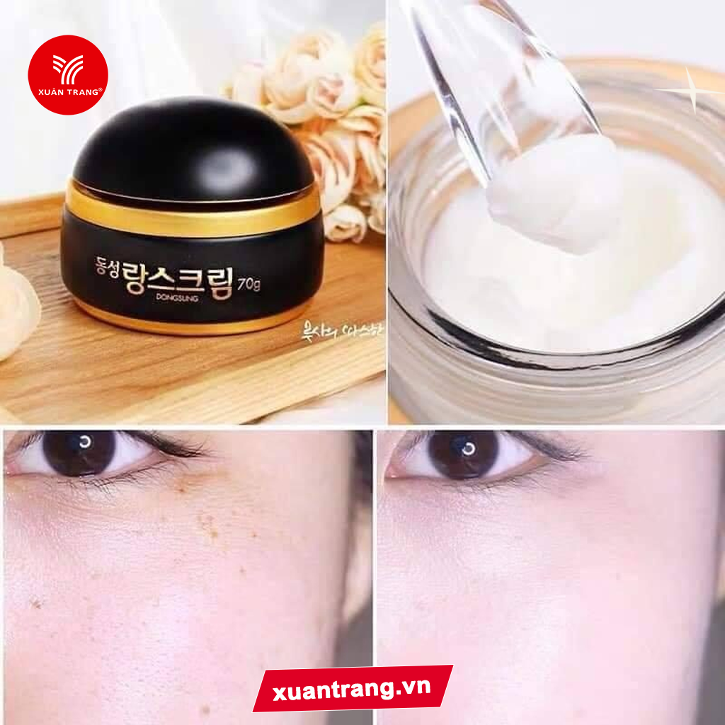 Dongsung_Kem Trị Nám Rannce Cream 10G Hàn Quốc‎